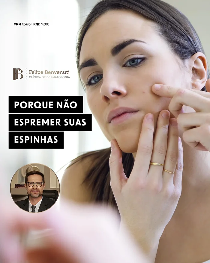 Porque não espremer suas espinhas?